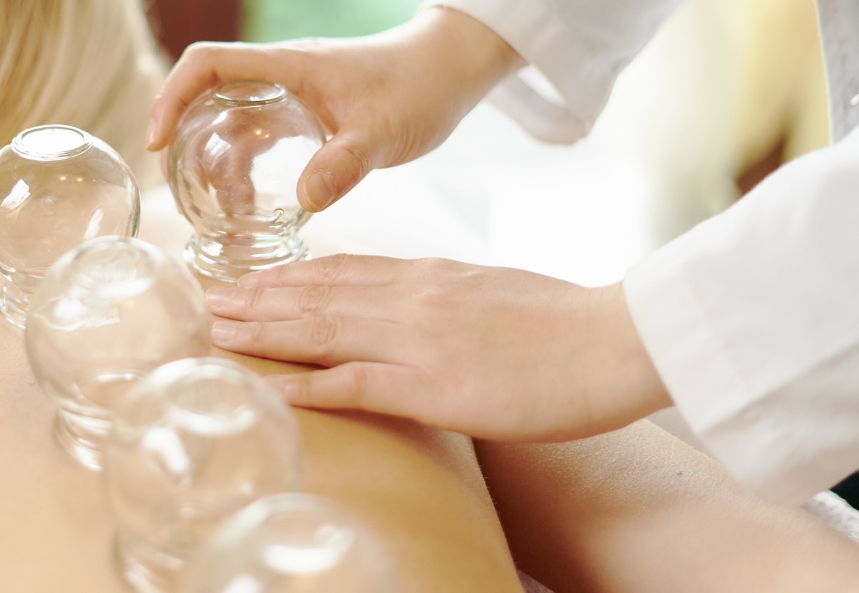 カッピング（走罐）